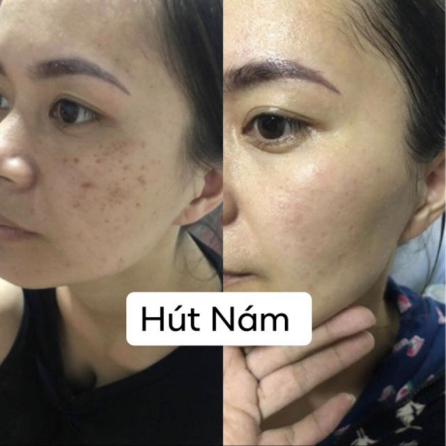 Vua khử nám nhật