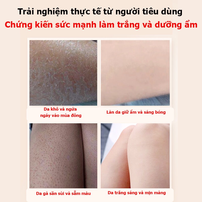 Kem dưỡng trắng cơ thể Niacinamide dưỡng ẩm da làm trắng da toàn thân không gây kích Làm trắng nhanh chóng