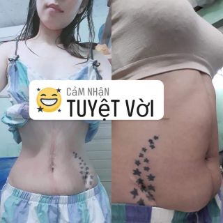 [FREESHIP] ĐAI NỊT BỤNG LATEX CORSET CHUẨN HY LẠP
