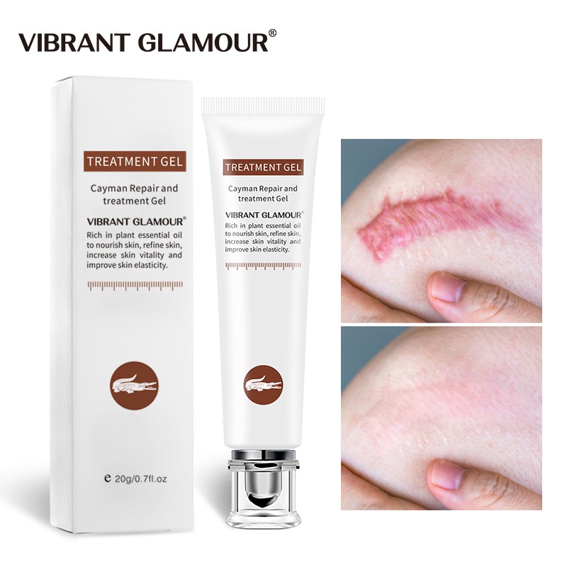 Gel VIBRANT GLAMOUR làm mờ sẹo vết rạn chai cải thiện các nốt mụn đầu đen dưỡng ẩm làm trắng da 20g | BigBuy360 - bigbuy360.vn