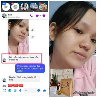 Mỡ trăn ngọc lan tây Nstore