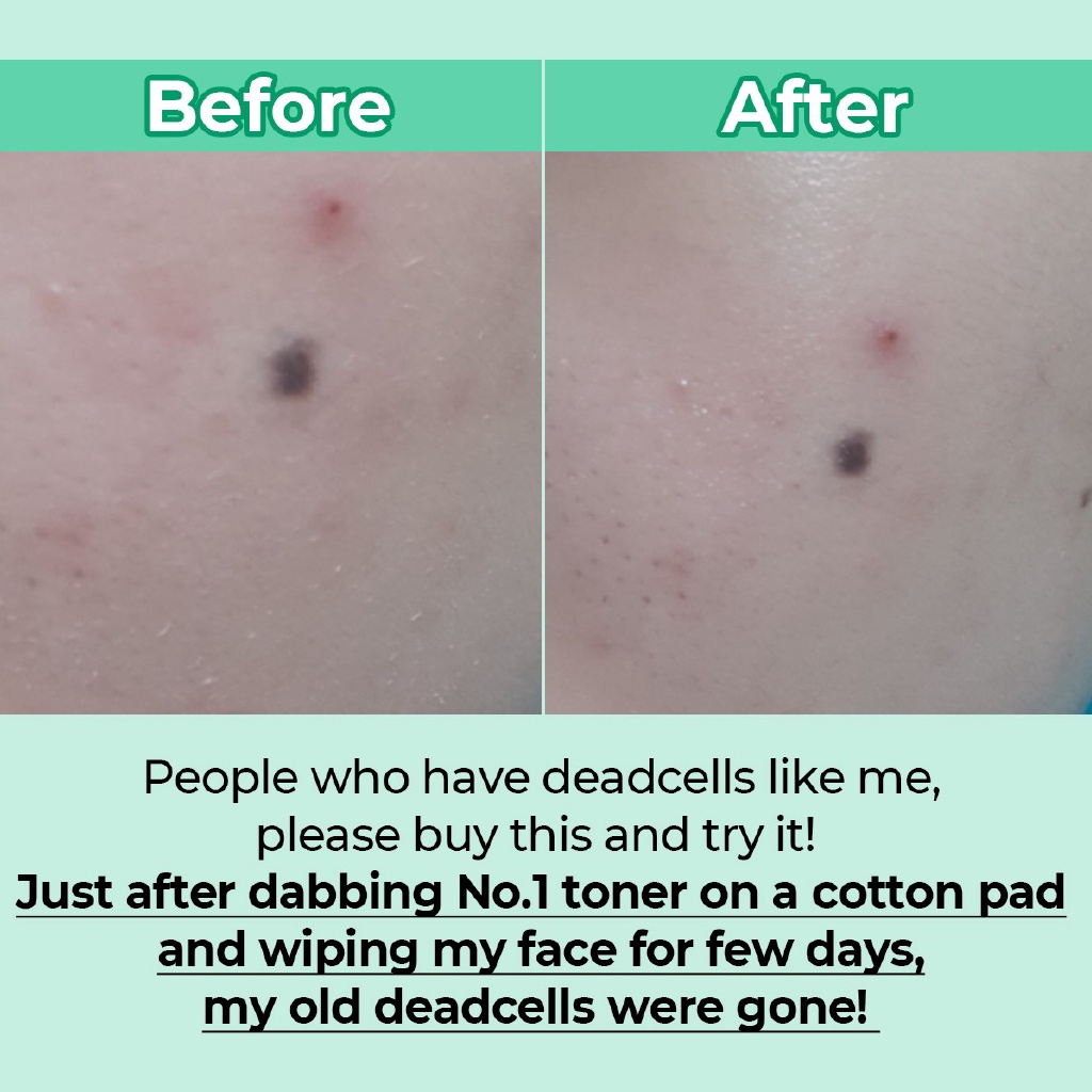 Toner NUMBUZIN No.1 tẩy tế bào chết hiệu quả 200ml