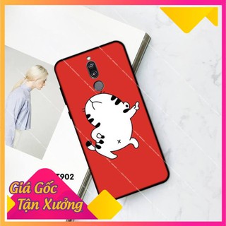 Ốp điện thoại HUAWEI NOVA 2i - Nova 3i - Nova 4E