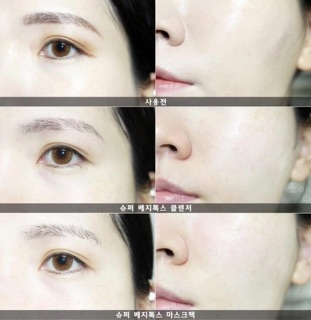 (Hộp 6 miếng) Set mặt nạ thải độc rau củ Super Vegitoks Mask Hàn Quốc