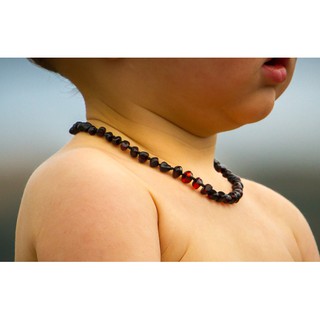 Vòng hổ phách đeo cổ cho bé Cherry