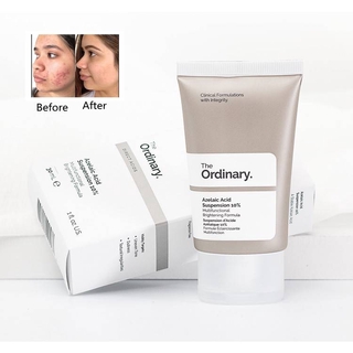 [Hàng mới về] Dung Dịch THE ORDINARY Acid Azelaic 10% 30ml Dưỡng Ẩm Tự Nhiên + Ha - 30ml / 100ml