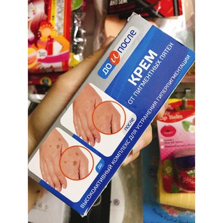 Kem đồi mồi tay chân KPEM