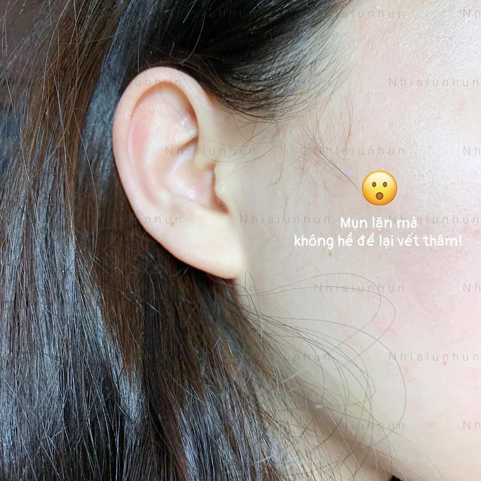 Miếng dán Some by mi Clear Spot patch