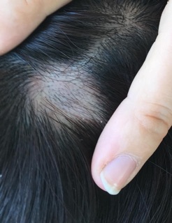 Serum bưởi Milaganics