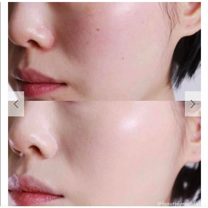 Kem chống nắng SJM Medical Anti UV Perfect SunScreen SPF50+/ PA++++ 60ml date 2025 - Hàng chính hãng Hàn Quốc