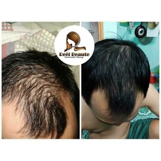 Tíu lọc gội đầu Rel'l Beauti thiên nhiên