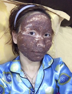 Mặt nạ ngũ hoa Tina Lê