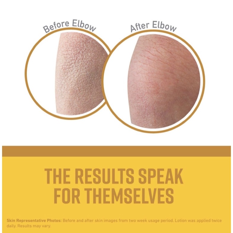 Kem giảm nứt gót chân, da tay, body O’Keeffe’s Working Hands Hand  Healthy Feet Foot Cream, and Skin Repair Body USA