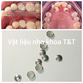 10 cái núm button chỉnh nha niềng răng