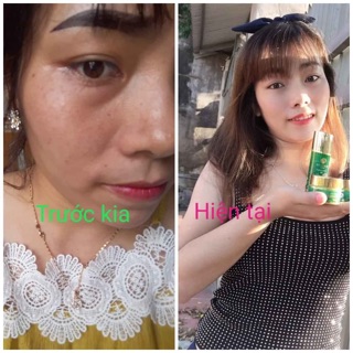 Mỹ phẩm 8x beauty