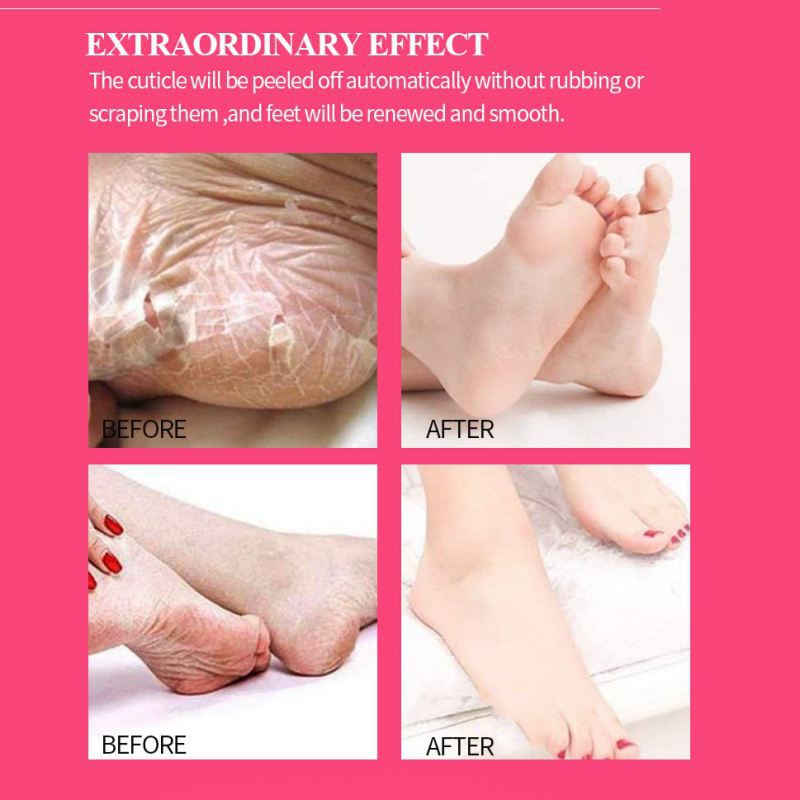 Rose Exfoliating Foot Mask Moisturizing Exfoliation for Legs Heels Remove Dead Skin Pedicure Peeling Feet Mask | BigBuy360 - bigbuy360.vn