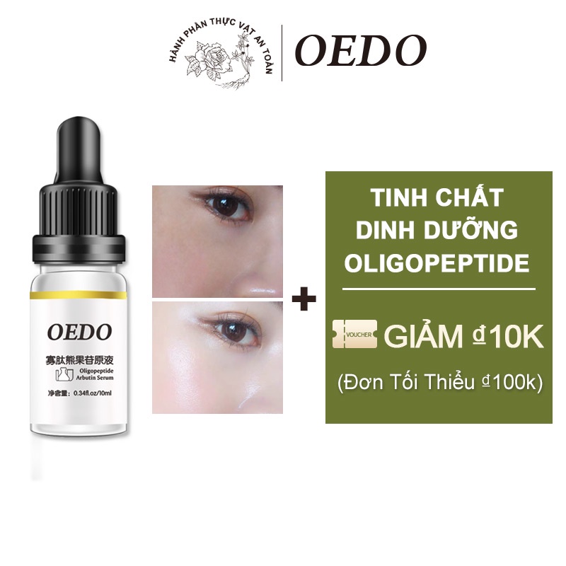 Oligopeptide Arbutin Serum OEDO Làm Dịu Sâu Cải Thiện Làn Da Xỉn Màu Dưỡng Ẩm Làm Trắng Da Tinh Chất Chăm Sóc Da chống lão hóa nếp nhăn 10ml