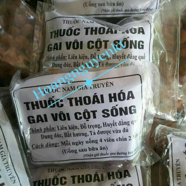 Thoái hóa gai vôi cột sống hiệu quả