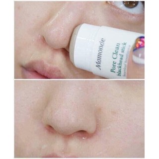 Thanh Lăn Mụn Đầu Đen Mamonde
