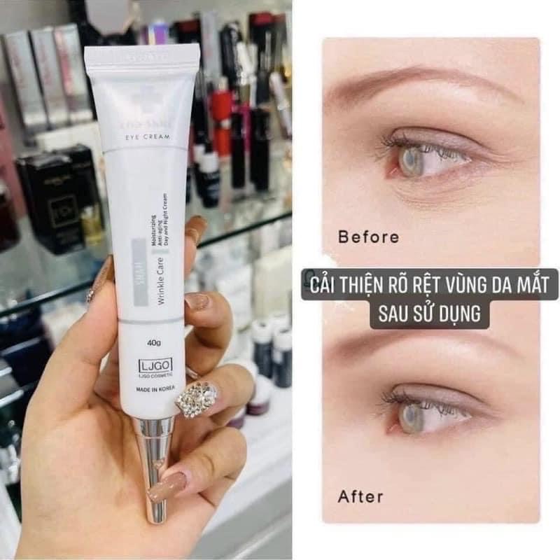 kem thâm mắt Kem Mắt Ốc Sên Cha Skin Snail Eye Cream kem tan bọng mắt giảm quầng thâm mắt kem dưỡng mắt chống thâm mắt