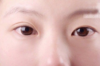 DÁN KÍCH MÍ LƯỚI 240 MIẾNG