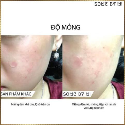 Miếng dán mụn Some By Mi Acnes Clear Patch gói 18 miếng SAC8