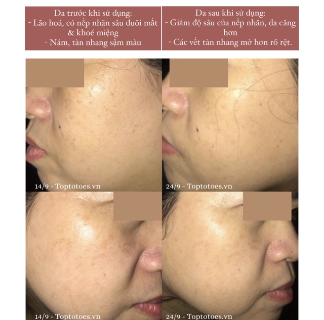 Serum Bielenda Retinol Neuro/ Mezo Skin Clinic trẻ hoá, làm da căng bóng, mờ thâm sẹo