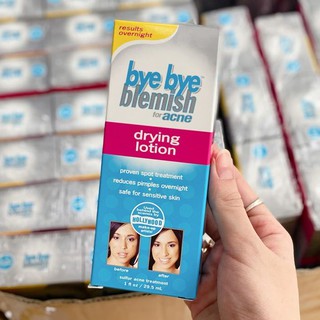 Kem Mụn Bye Bye Blemish Drying Lotion