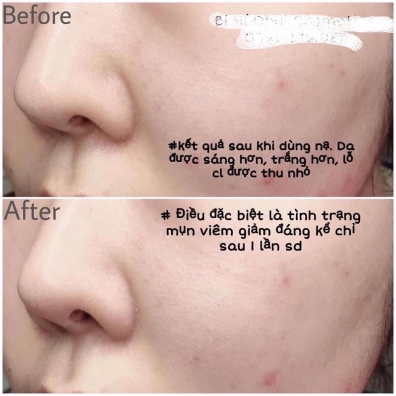 Mặt nạ đất sét sulwhasoo trắng da ngừa mụn thải độc hút dầu Herbal clay purifying Mask 35ml