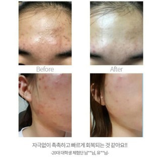 Kem Chấm Mụn Cellmula Ac Clear Spot