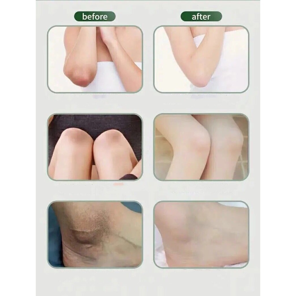 Kem làm trắng da vùng dưới cánh tay/ đầu gối/ chân/ vùng kín 70g tiện dụng