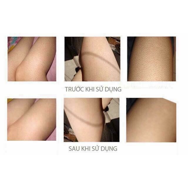 TẤT PHUN NUDE TENDENCY