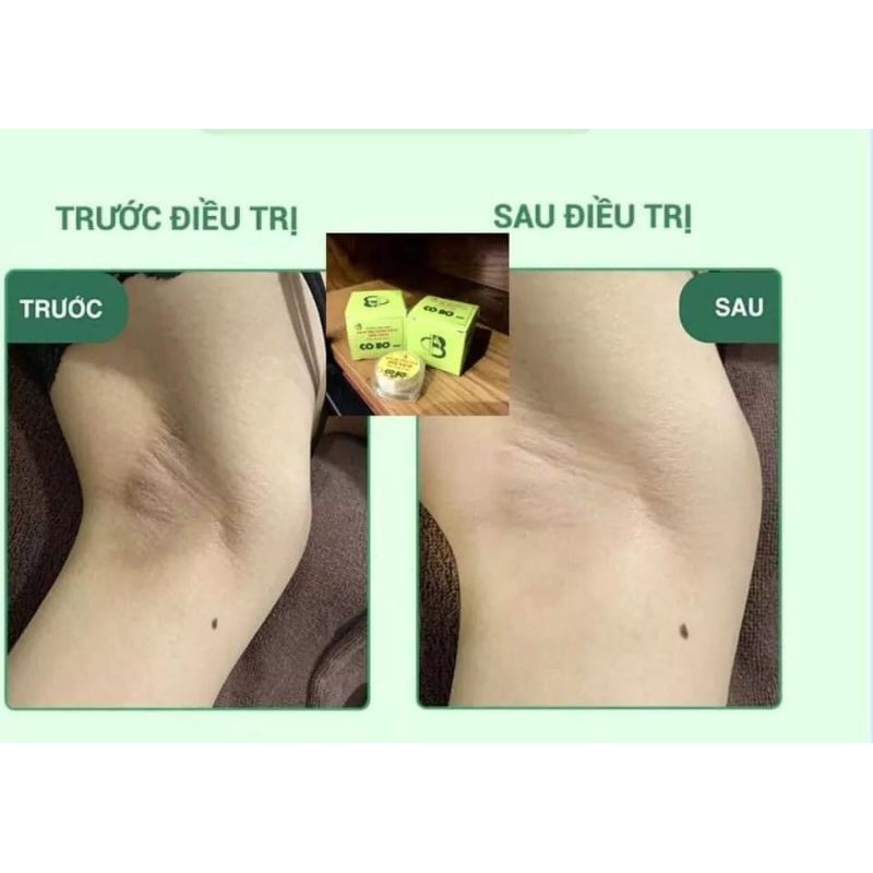 (TẶNG QUÀ)COMBO 3 HỘP KEM KHỬ THÂM NÁCH HÔI NÁCH CÔ BƠ