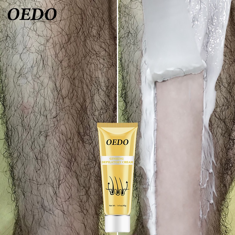 Kem tẩy lông OEDO triệt lông nách, chân, tay, bikini, vùng kín, an toàn và không gây không gây kích Ứng Và Đau Với 40g