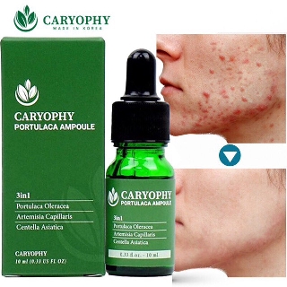Tinh Chất Cho Da Mụn Caryophy Ampoule 10ml (sỉ mỹ phẩm 05)