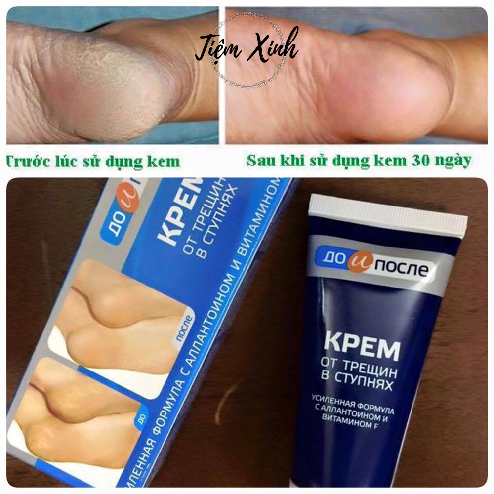 Kem nứt gót chân Kpem Apteka Nga 50ml kem dưỡng da chân, nẻ gót chân, dưỡng da chân mềm mịn