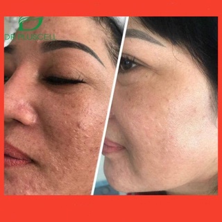 Tinh chất tế bào gốc 6gf dr pluscell 8ml