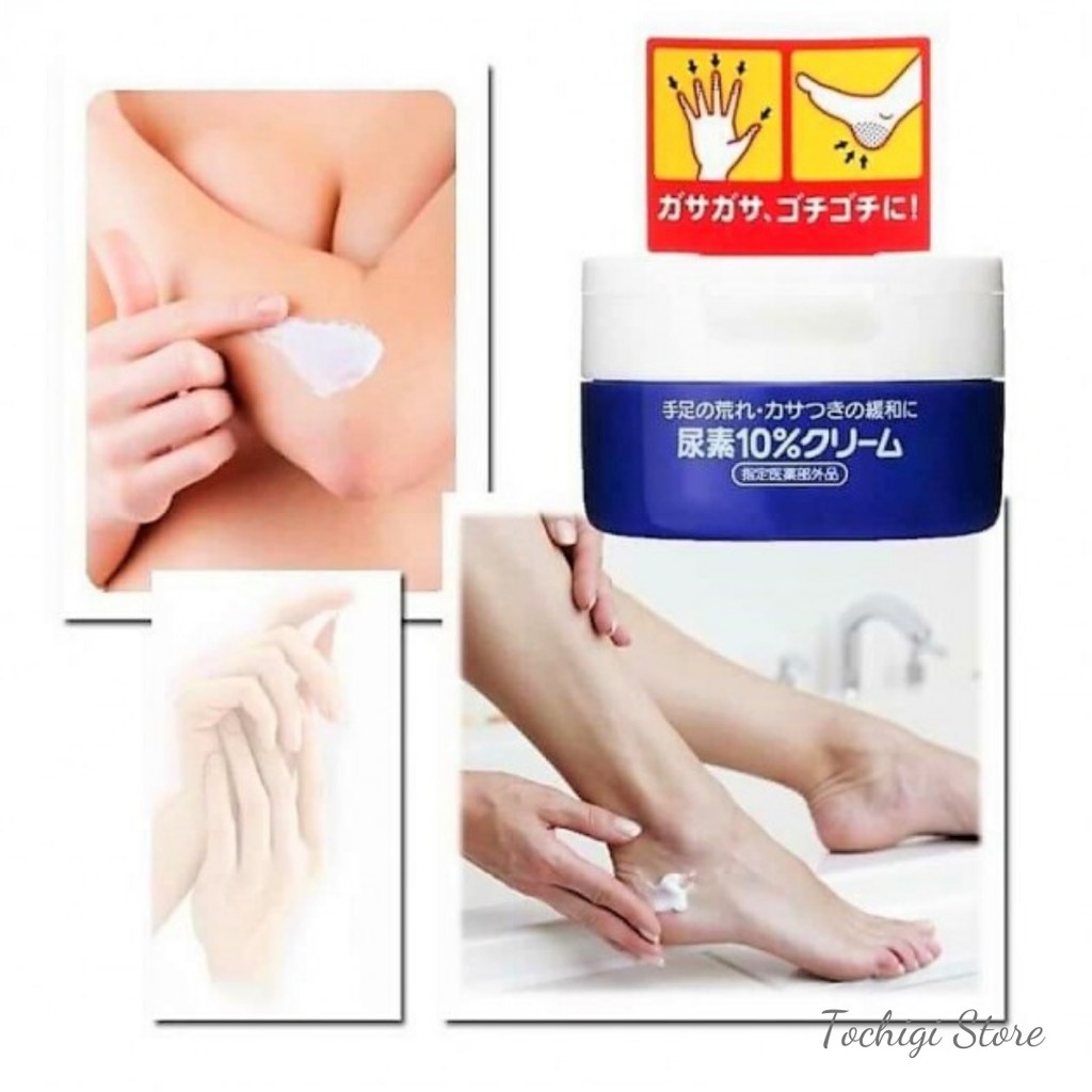 Kem dưỡng chân tay Shiseido Urea Cream Nhật Bản ngăn ngừa nẻ