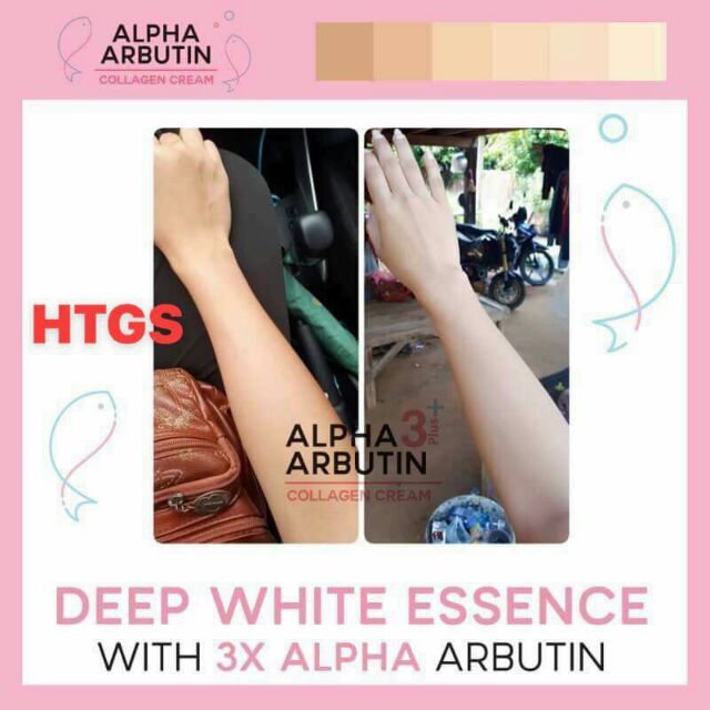 Kem kích trắng body alpha arbutin 3 plus