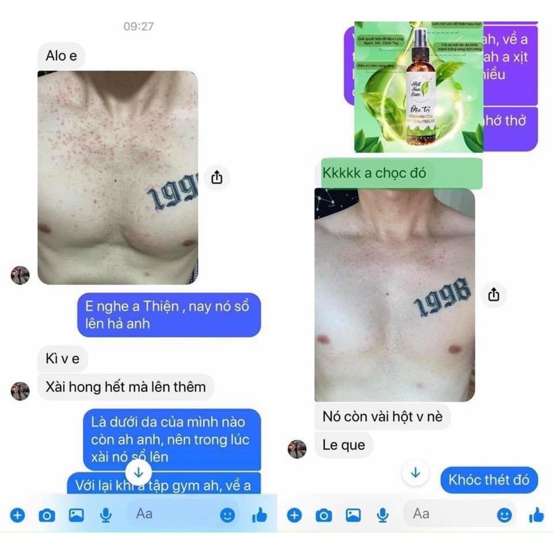 Xịt mụn lưng Nhất Nam dược ⚡️Freeship ⚡️ đánh bay mụn, thâm, viêm nang lông trên cơ thể. | BigBuy360 - bigbuy360.vn