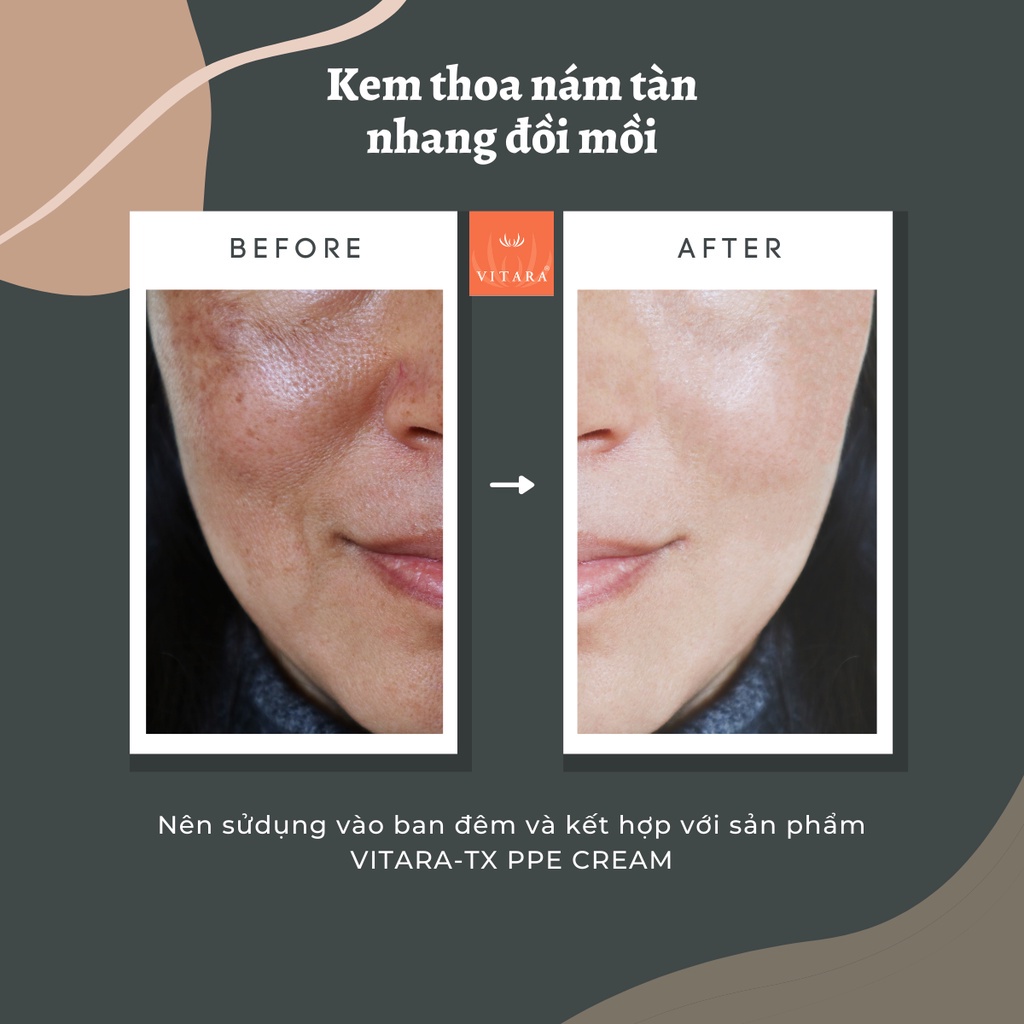 Kem Thoa Nám Tàn Nhang Đồi Mồi Vitara -TX PPE Thái Lan 15gr