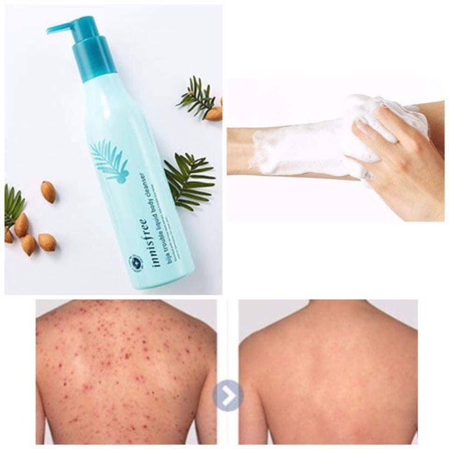 SỮA TẮM TRỊ MỤN Ở LƯNG INNISFREE BIJA TROUBLE LIQUID BODY CLEANSER 300ml mẫu mới | BigBuy360 - bigbuy360.vn