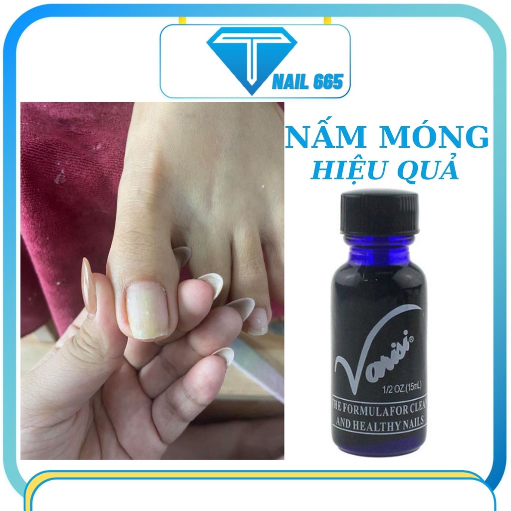 Dưỡng móng chống nấm móng tay nail , Kem bôi Nấm móng chân tay VIRASI