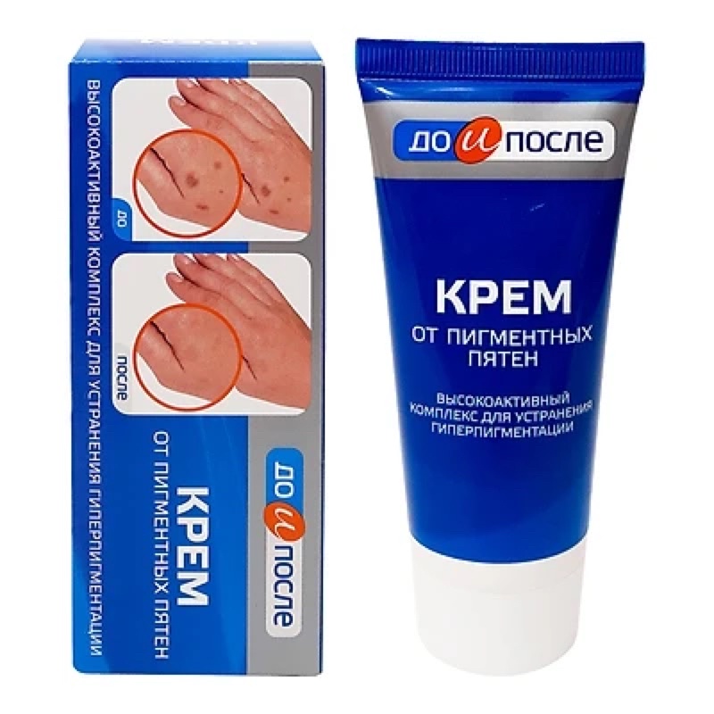 Kem Ngừa Đồi Mồi Chống nhăn Và Dưỡng Trắng Da Tay KPEM 50ml NGA