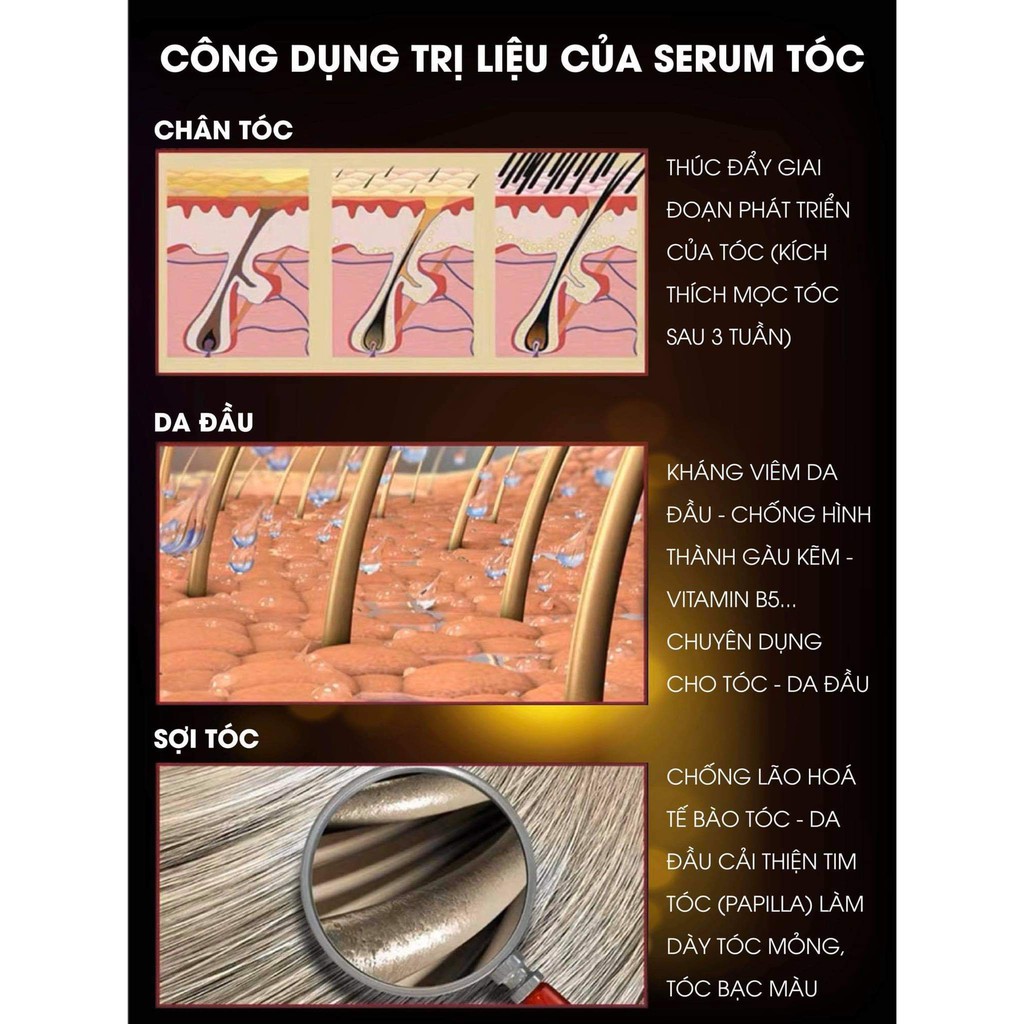 [Dùng Thử Lọ 5ml] Hỗ Trợ Kích Mọc Tóc Nhanh Huyết thanh Serum Mọc Tóc Weilaiya Chính Hãng Cam Kết Hiệu Quả Sau 12 Tuần | BigBuy360 - bigbuy360.vn