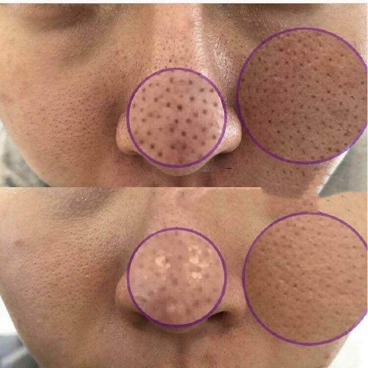 Máy rửa mặt Nuskin Lumispa ageloc