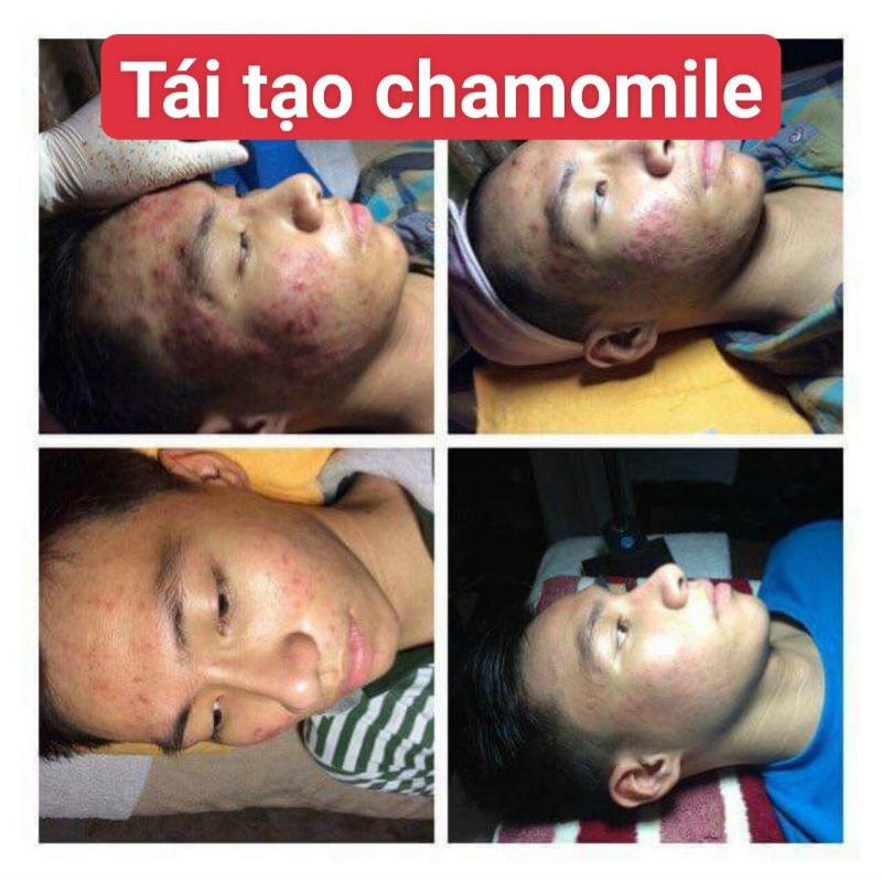 Kem tái tạo Chamomile hồng sâm