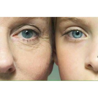 Serum trẻ hóa vùng mắt