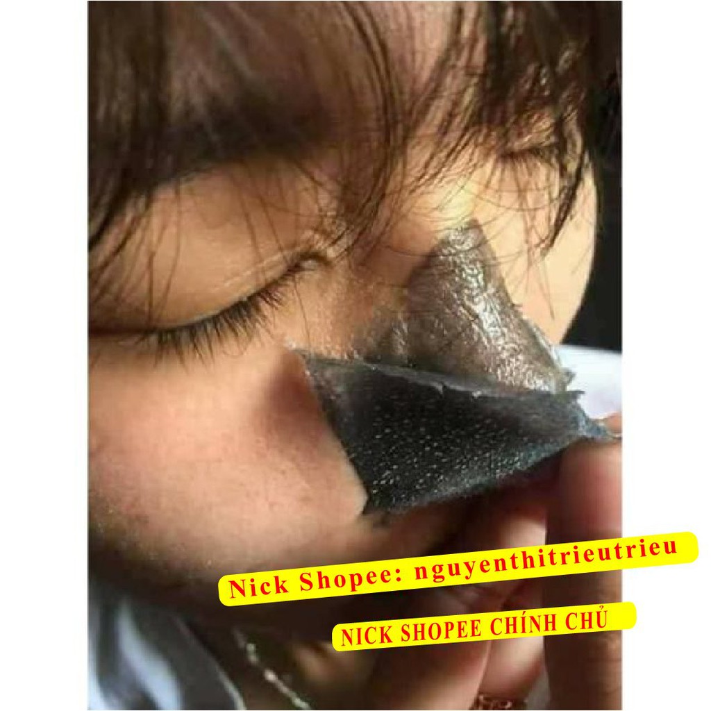 [100% Chính Hãng] Mặt Nạ Gel Hút Mụn Than Tre Hoạt Tính Ngân Bình > Gel lột mụn Than Tre, Lột mụn cám, mụn đầu đen,... | BigBuy360 - bigbuy360.vn