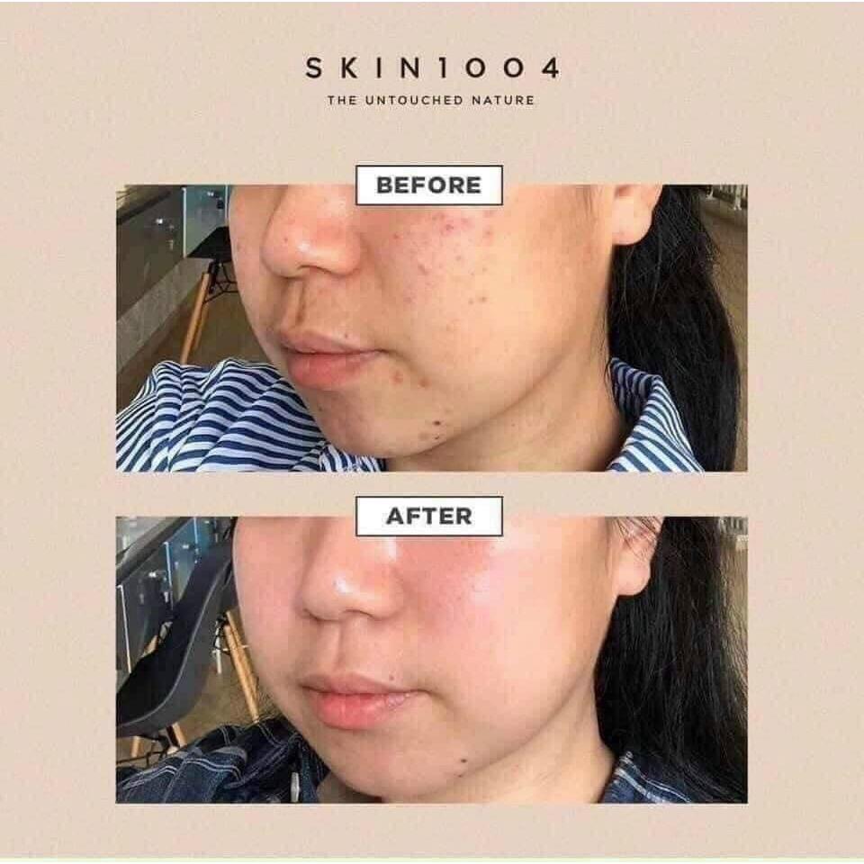 SKIN1004 - Kem Rau Má Dưỡng Ẩm Phục Hồi 75ml